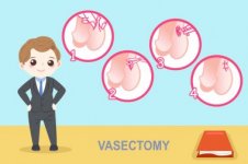 depositphotos_193483230-stock-illustration-man-with-vasectomy.jpg